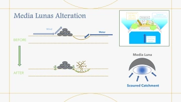 Media Lunas Alteration